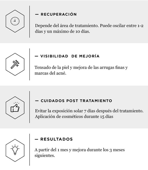 tabla_02